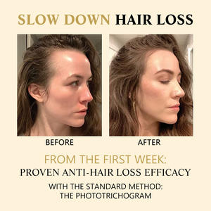 Esencia Capilar Roll-on <span class=keywords><strong>West</strong></span>&Month de 20 ml con Logotipo Personalizado, Reduce la Caída del Cabello, Fortalece y Oscurece, Suero de Masaje - Product Image 5