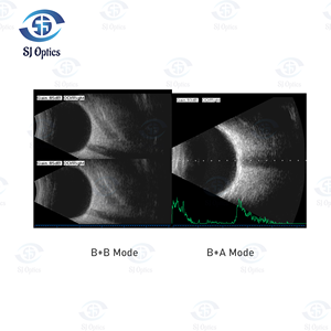 SJ Optique Ophtalmique Ab Scan Machine À Ultrasons SAB-500 Échographie AB Scan Maladies Intraoculaires Diagnostic Scanner - Product Image 4