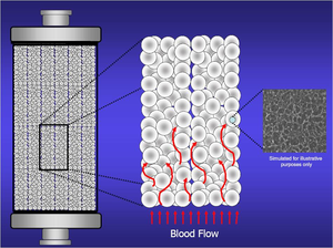 ทางการแพทย์ปกติเลือดบริสุทธิ์ผลิตภัณฑ์ทางการแพทย์ทิ้ง Hemoperfusion ตลับ - Product Image 6
