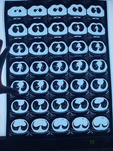 <span class=keywords><strong>Film</strong></span> médical radiographique bleu à jet d'encre à haute rigidité et dureté, <span class=keywords><strong>film</strong></span> PET d'usine - Product Image 6