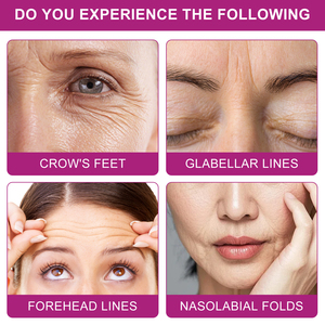 Parches Triangulares IKZEE 162 Unidades para <span class=keywords><strong>Arrugas</strong></span> Faciales, Cuidado Nocturno de la Piel, Parches Reafirmantes No Invasivos para <span class=keywords><strong>Frente</strong></span> y Líneas de Expresión - Product Image 4