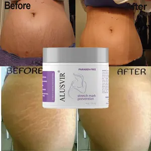 Krim Penghilang Stretch Mark, Label Pribadi 100% Perbaikan Kulit Vegan Alami Anti Pasca Melahirkan, Penghilang Bekas Luka Jerawat Dalam