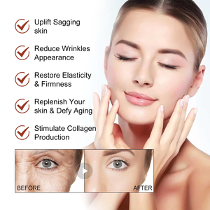 Esencia facial de ácido hialurónico, antiarrugas y Antienvejecimiento, reafirmante, piel amarilla, brillo y aclaramiento - Product Image 3
