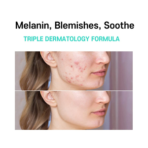 Soins de la peau, Centella Asiatica, crème hydratante éclaircissante, apaisante, atténuant les taches brunes, traitement du mélasma, crème <span class=keywords><strong>pour</strong></span> le visage <span class=keywords><strong>pour</strong></span> une peau éclatante - Product Image 6