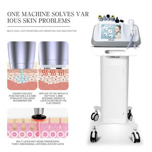 Strumento di Bellezza Facciale Multifunzione a Ultrasuoni Caldo/Freddo per Esfoliare, Affinare la Pelle, Calmare i Pori e Levigare il Contorno del Viso - Product Image 5