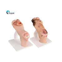 Modelo de pie diabético (leve/grave) para entrenamiento médico y educación