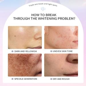 Suero Blanqueador y Antipecas 377 de 30 ml para el Cuidado de la Piel del Rostro, Aclara las Manchas Oscuras e Hidrata (Oferta) - Product Image 2