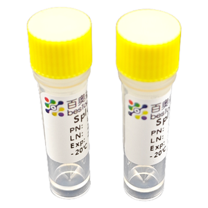 Lá lách phân ly Kit (10 thử nghiệm) phân ly của mô cho nghiên cứu ISO 9001 ba3324 - Product Image 6