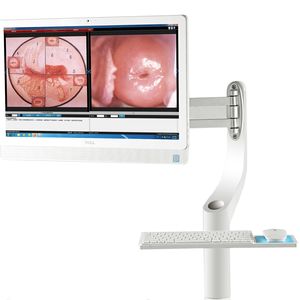 डिजिटल HD इंडोस्कोपिक कैमरा colposcope योनि लचीला योनि <span class=keywords><strong>endoscope</strong></span> उच्च अंत ऑप्टिकल colposcope - Product Image 2