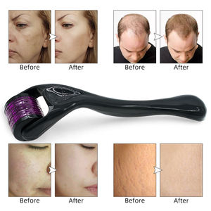 Producto de Cuidado Personal Certificado, Derma Roller 540 con Agujas de 0.2mm/0.25mm/0.5mm/0.75mm/1.0mm/1.5mm/2.0mm/2.5mm - Product Image 4