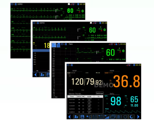 เครื่องวัดสัญญาณชีพ EUR VET ราคาดีที่สุด เครื่องตรวจวัดสัญญาณชีพผู้ป่วย เครื่องวัดความดันโลหิต CO2 <span class=keywords><strong>อุปกรณ์</strong></span>สัตวแพทย์ - Product Image 6