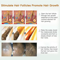 Produits phares OEM Personnalisé Meilleur sérum contre la perte de cheveux Sérum de croissance capillaire pour hommes Bloqueur de DHT Sérum de croissance capillaire