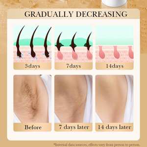 Crème dépilatoire douce pour les aisselles, à succès, au collagène, lisse les taches noires, sans irritation, prix usine, permanente - Product Image 5