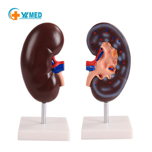 Modelo anatómico de riñón de enseñanza, sistema urinario, anatomía, modelo de riñón humano, modelo anatómico de riñón de plástico humano - Product Image 1