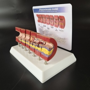 Model Anatomi Aterosklerosis Manusia, Penyumbatan Patologis Intima, Stenosis, Akumulasi Lemak, Jantung Lansia Paruh Baya - Product Image 3