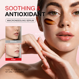 Atacado Private Label 50ML Dragão Sangue Stoste Hidratante Encolher Poros Idade-Envelhecimento Cuidados Com A Pele Soro Dragão Sangue Soro OEM d - Product Image 3