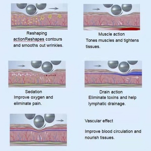 Rodillo de Bolas Magnético Profesional con Rotación de 360° para Masaje Corporal, Fisioterapia, Adelgazamiento y Belleza - Product Image 4