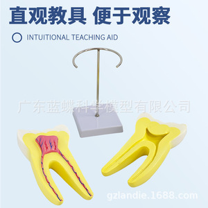 Modèle anatomique de molaire humaine, grande dent pour l'enseignement en maternelle et la formation médicale, avec base et support. - Product Image 5