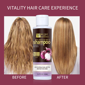 Vitalty 150ml <span class=keywords><strong>Shampooing</strong></span> d'usine Soin capillaire bio à l'oignon rouge pour femmes Restaure la brillance Hydratation Sans parabènes pour <span class=keywords><strong>cheveux</strong></span> abîmés - Product Image 5