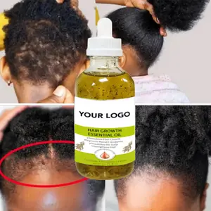 Label pribadi 100% minyak Almond kastor Rosemary organik alami pria wanita Serum perawatan kulit kepala minyak pertumbuhan Perawatan Rambut