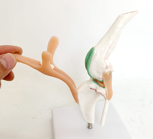 Hunde kniegelenk modell Stadien des Osteoporose modells für Hunde - Product Image 3