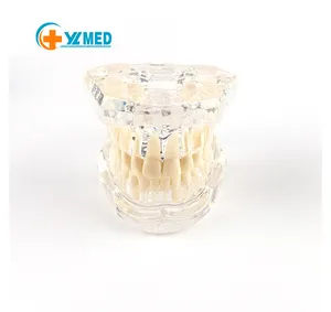 用于医患沟通的透明牙龈牙齿模型颌骨模型