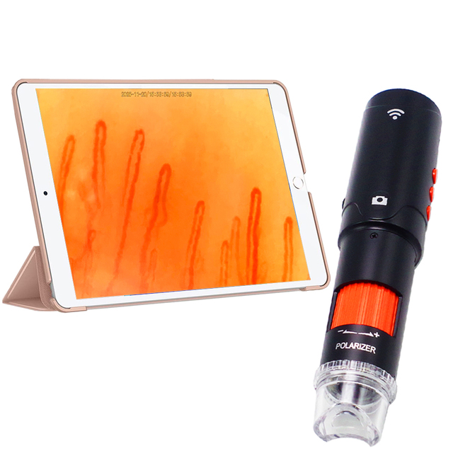 Nailfold Capillary Capillaroscope with High Magnification 400x Polarizer Light for Health Analysis