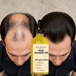 Traitement capillaire naturel et biologique anti-chute à marque privée, mélange <span class=keywords><strong>d</strong></span>'<span class=keywords><strong>huile</strong></span> <span class=keywords><strong>d</strong></span>'argan et <span class=keywords><strong>de</strong></span> romarin pour la croissance des cheveux et les <span class=keywords><strong>bienfaits</strong></span> antipelliculaires - Product Image 4