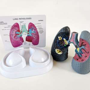 Modelo Anatómico Patológico de Corazón y Pulmón Humano con Imágenes - Medicina - Modelo del Sistema Respiratorio Pulmonar - Product Image 2