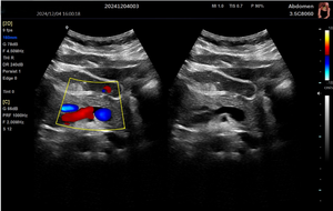 Ecógrafo Doppler Color Portátil DMU71 con Pantalla de 15.6 Pulgadas de Alta Resolución y Escáner 4D, Precio para Uso Humano y Veterinario - Product Image 5