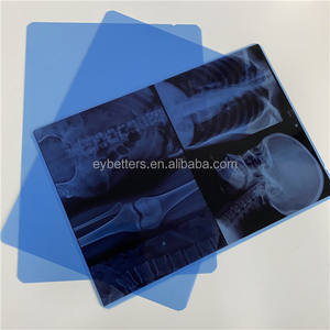 תעשייתי קולנוע רנטגן מחזור הצופה תיבת אור פאנל אור - Product Image 5