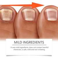 Solution réparatrice pour les ongles au venin d'abeille 50 ml pour les soins des mains et des pieds BEE VENOMNAIL FUNGUS