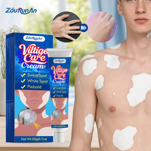 ZouRunAn krim penghilang Vitiligo, perawatan pigmentasi untuk kerusakan matahari, mengurangi noda & pengencangan warna kulit, perbaikan mendalam - Product Image 1