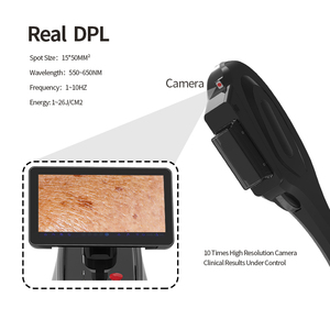 Machine portable IPL Machine Rajeunissement de la peau IPL E Light Nouvel équipement de <span class=keywords><strong>photorajeunissement</strong></span> - Product Image 3