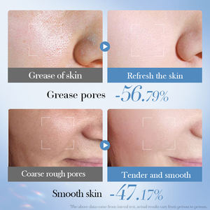 Crème pour le visage à l'acide salicylique 60g avec contrôle <span class=keywords><strong>de</strong></span> l'huile, éclaircissant, blanchissant, hydratant, vente en gros, soin <span class=keywords><strong>de</strong></span> la <span class=keywords><strong>peau</strong></span> du visage personnalisé, cosmétique - Product Image 5