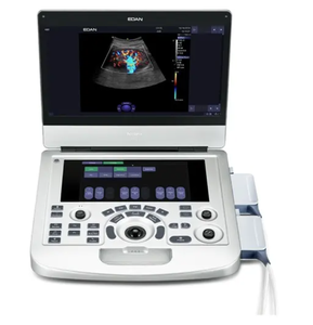 Ecógrafo Doppler Color Portátil Ligero Edan AX3 para Exámenes Vasculares, Obstétricos/Ginecológicos y Cardíacos - Product Image 2