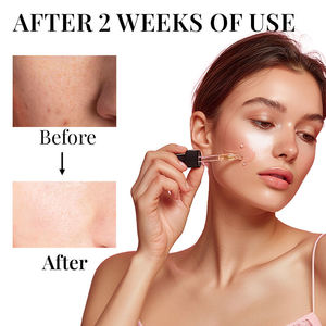 Sérum pour le visage de marque privée avec acide hyaluronique vitamine C niacinamide sérum hydratant anti-rides pour le visage réparation et éclaircissement - Product Image 5