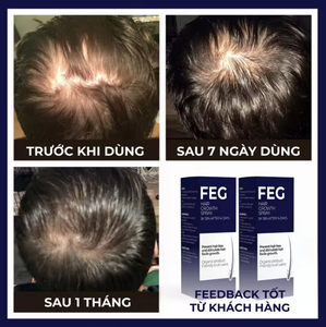 منتجات العناية بالشعر السريعة في 7 أيام، علاج تساقط الشعر FEG PLUS، بخاخ نمو الشعر 50 مل - Product Image 5