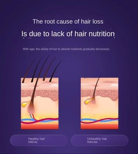 Cepillo Masajeador Eléctrico para el Cuero Cabelludo 6 en 1 con Microcorriente EMS y Spray de Nano Niebla para el Crecimiento del Cabello - Product Image 6