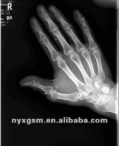 Película Blanca para Impresión Médica por Inyección de Tinta - Product Image 6