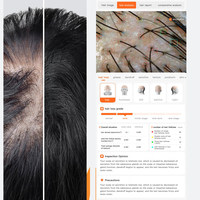 Professioneel 50x Scalp Imaging Apparaat voor Kapsalons, Diagnostiseert Roos met AI Digitaal Rapport, Scalp Behandelingshub