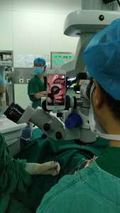 デジタルスリットランプイメージングモジュールアダプターMarco for <span class=keywords><strong>Topcon</strong></span> Z Eiss Slit Lamps Optics Instruments for Operating - Product Image 6