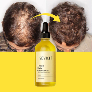 Huile essentielle de soins capillaires ordinaires nourrissante et réparatrice à l'extrait de romarin biologique avec étiquette personnalisée - Product Image 3
