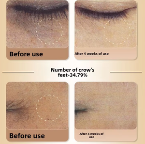 Masseur facial à lumière rouge, compresse froide et chaude, anti-âge, soin de la peau à domicile, appareil de beauté - Product Image 4