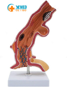 Modelo Patológico de Enfermedad Esofágica Humana para Ciencias Médicas, Modelo de Estómago para Enseñanza del Departamento de Gastroenterología del Hospital, Yulin CE/ISO - Product Image 1