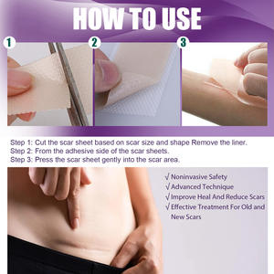 South <span class=keywords><strong>Moon</strong></span> Parche de silicona Cicatrices Cicatriz Hojas de gel Hoja de eliminación de cicatrices de silicona con tamaño 7,5*4cm - Product Image 6