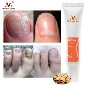 Ongles à base de plantes Onychomycose Paronychia Anti Fongique Nail Infection Bon Résultat Chinois À Base De Plantes Toe Nail Fungus Cream - Product Image 4