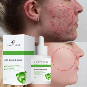 Suero Antiacné y Antiedad, Suero Blanqueador Fuerte Antiarrugas 30ml para Venta al Por Mayor Personalizado - Product Image 1