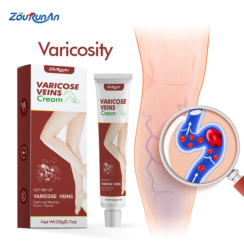 Zourunan Varicose Veins Ointment Veins Pain Phlebitis Spider Leg Health Care Herbal Cream Relieves Legs Pain Smoothing