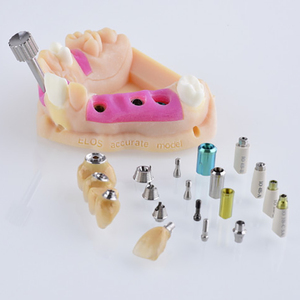 Giá Rẻ Giá In 3d Nha Khoa Bảo Vệ Mô Hình Dịch Vụ SLA SLS 3d Máy In Nhà Máy Cung Cấp Các Bộ Phận Y Tế 3d In Ấn Nhà Sản Xuất - Product Image 5